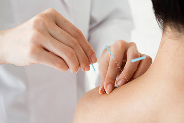 Medical Acupuncture in a chiropractic clinic